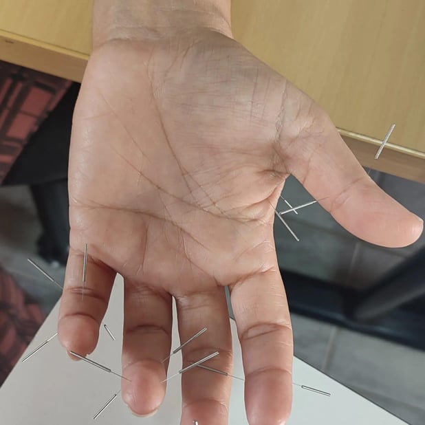 : Foto 11
