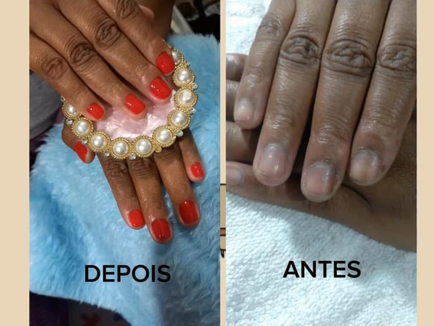 : Foto 8
