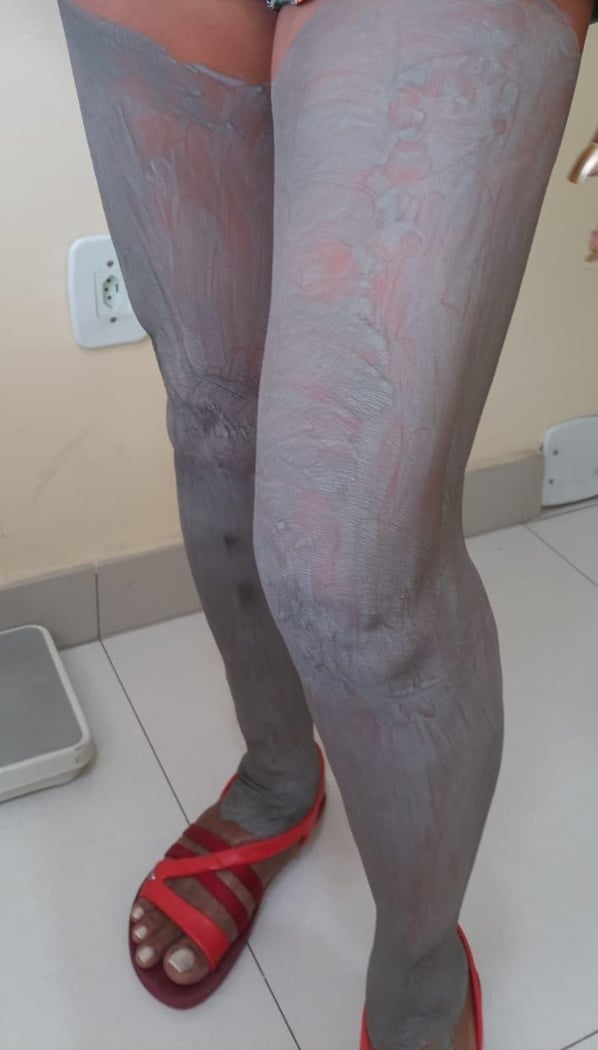 : Foto 4