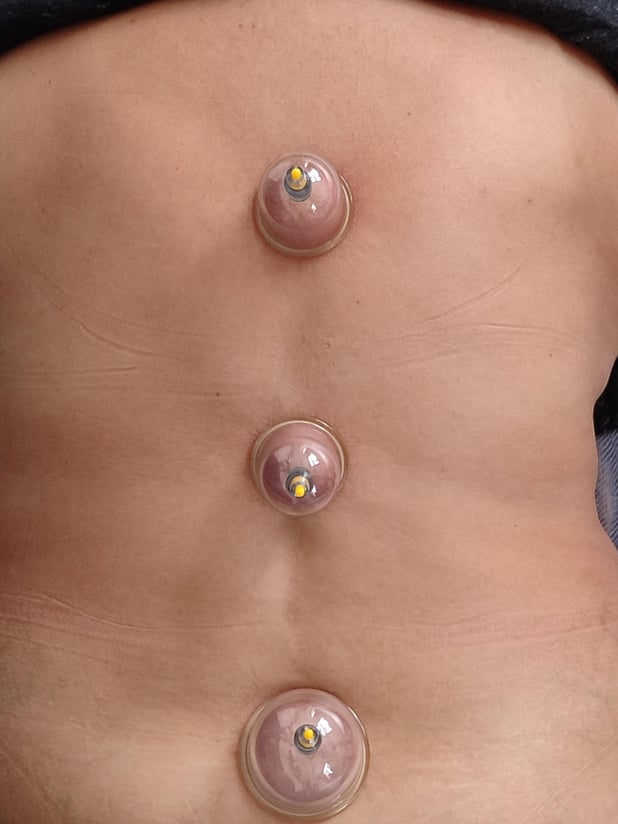 : Foto 10