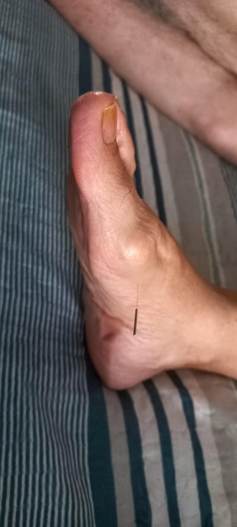 : Foto 1