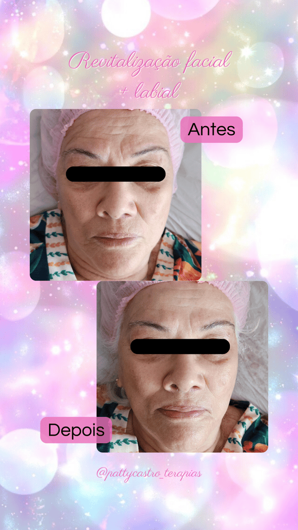 : Foto 1