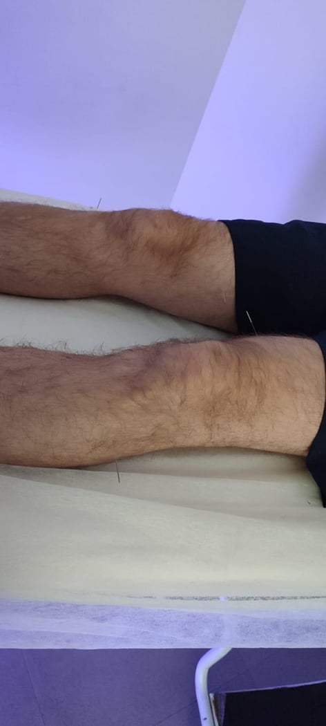 : Foto 4