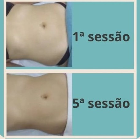: Foto 10