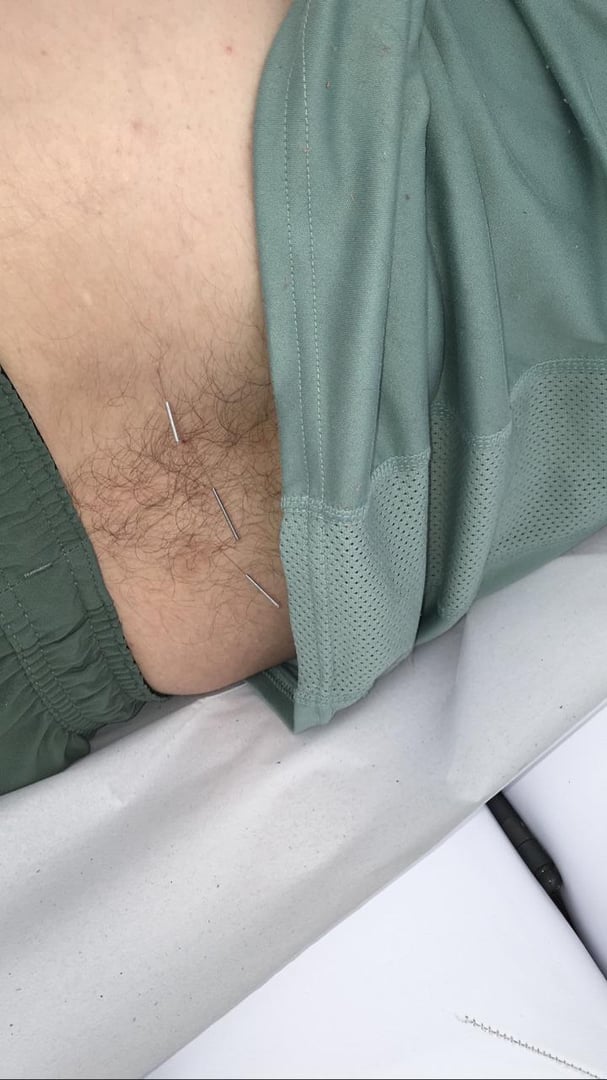 Foto 5 de 10