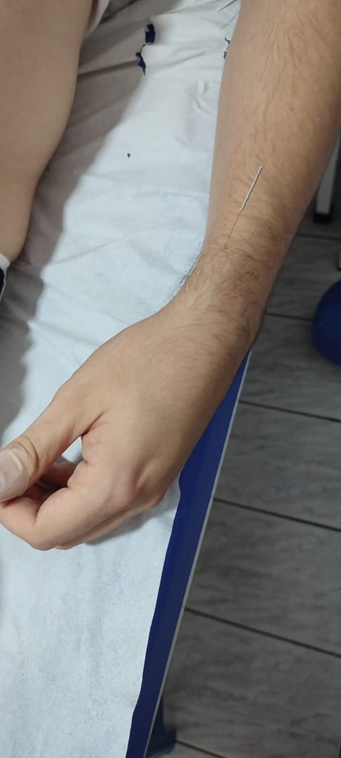 Foto 4 de 10