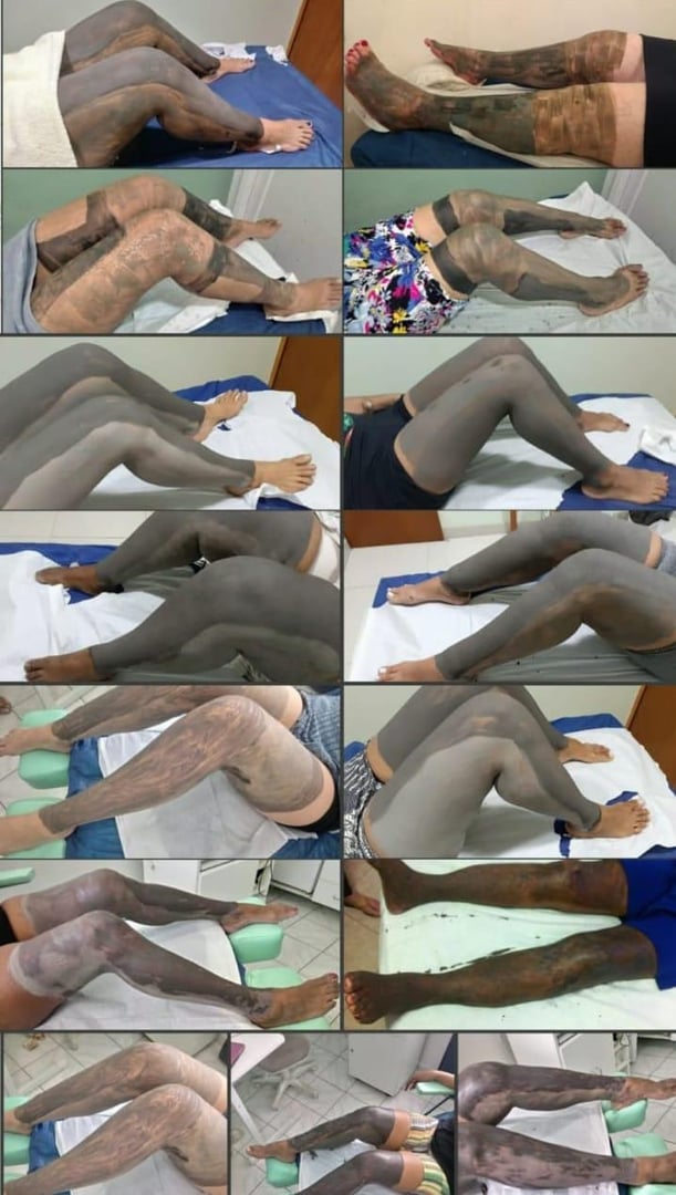 Foto 3 de 4