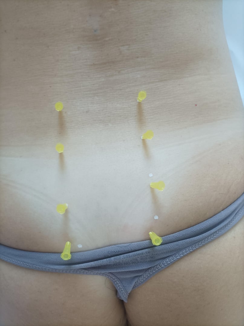 Foto 5 de 5