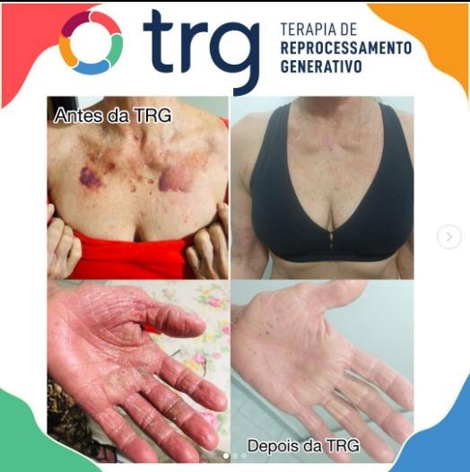 Foto 2 de 6