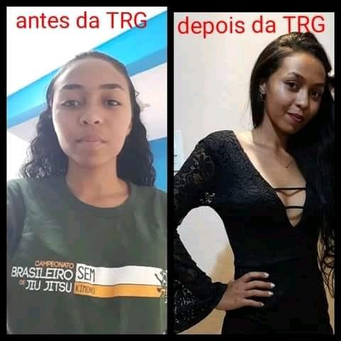 Foto 4 de 6