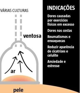 Foto 5 de 11