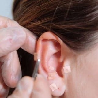 Sessão de Auriculoterapia