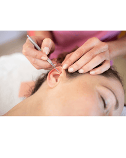 Auriculoterapia