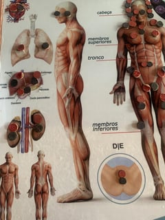 Terapia de Biomagnetismo