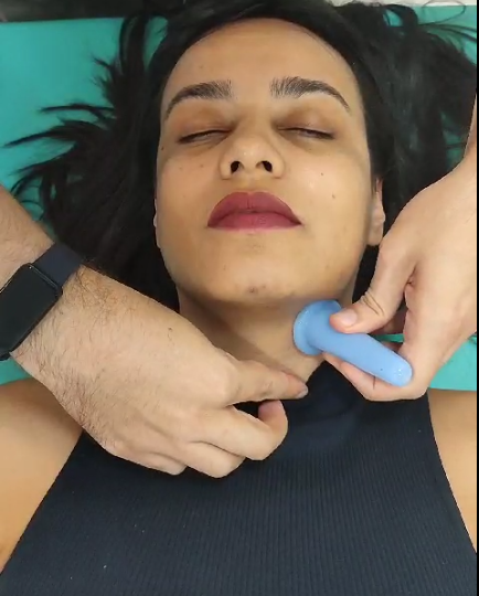 Acupuntura Estética