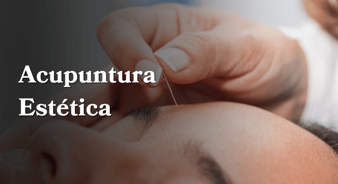 Acupuntura Estética