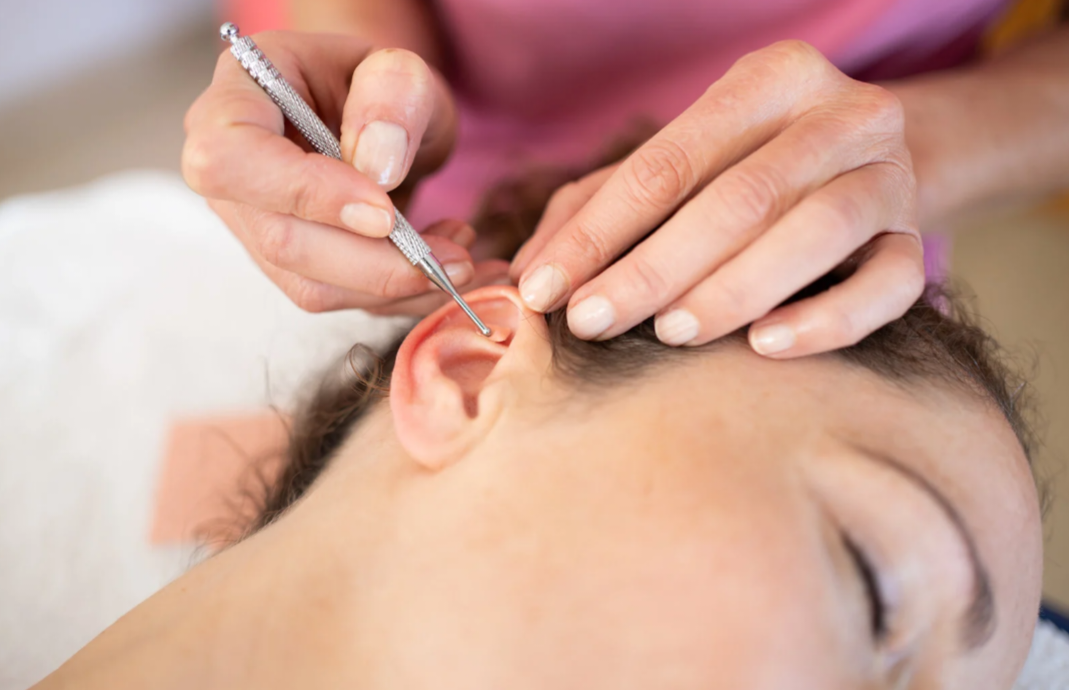 Sessão de Auriculoterapia
